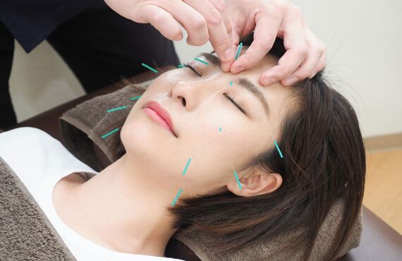 お肌のしみ・クマを美容鍼で明るい印象に改善| 阿佐ヶ谷で鍼灸を行うはりきゅうマッサージ マホロバ治療室
