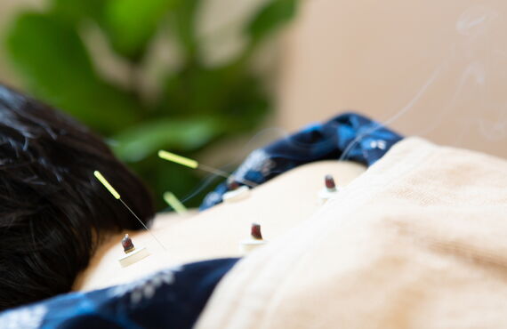 マッサージだけでは慢性肩こりが解消されない方ははりきゅうマッサージマホロバ治療室で鍼灸治療がおすすめです