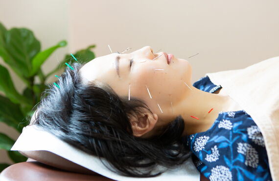 お得に継続して頂ける美容鍼回数券があります｜はりきゅうマッサージマホロバ治療室